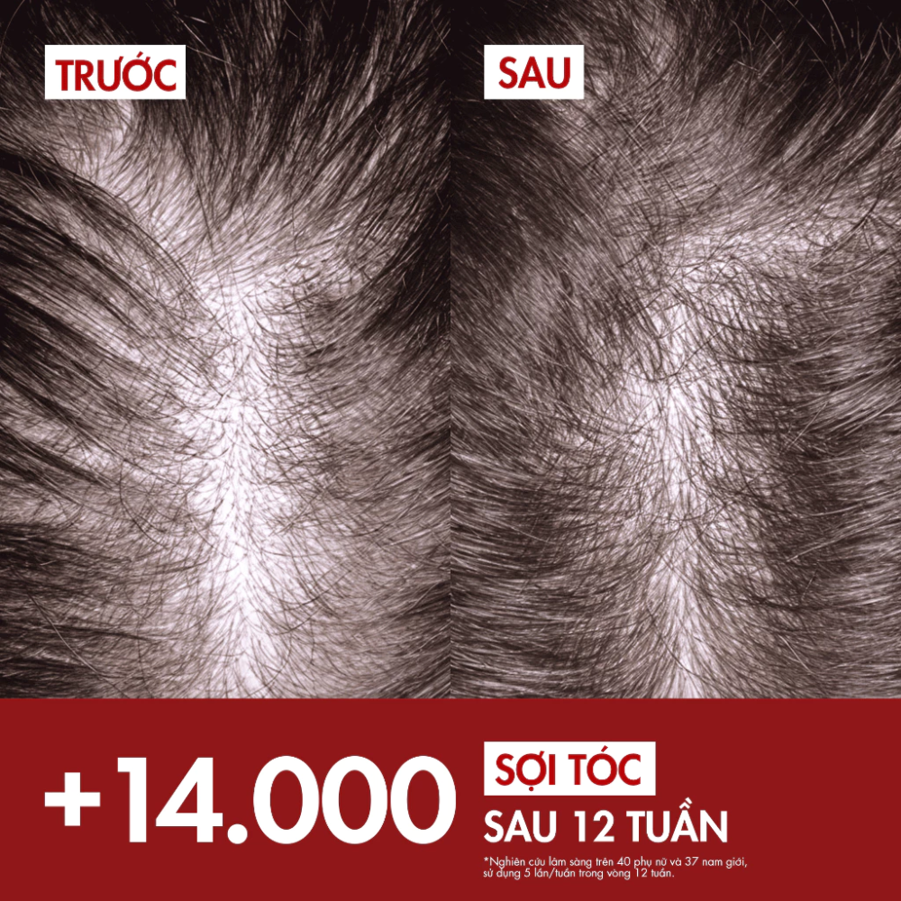 Tinh Chất Ngăn Rụng Tóc Và Làm Dày Tóc Vichy Dercos Aminexil Clinical R.E.G.E.N. Booster Hair Renewing Serum 90ml