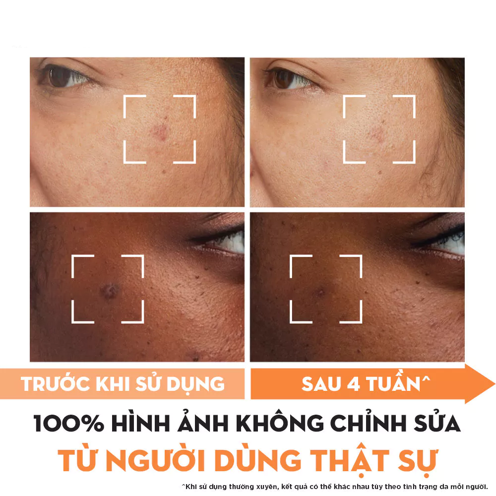 Kem Dưỡng Ẩm Trắng Da Mờ Vết Thâm Đốm Nâu Olay Niacinamide & Vitamin C Moisturizer 50g
