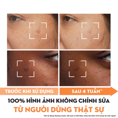 Kem Dưỡng Ẩm Trắng Da Mờ Vết Thâm Đốm Nâu Olay Niacinamide & Vitamin C Moisturizer 50g