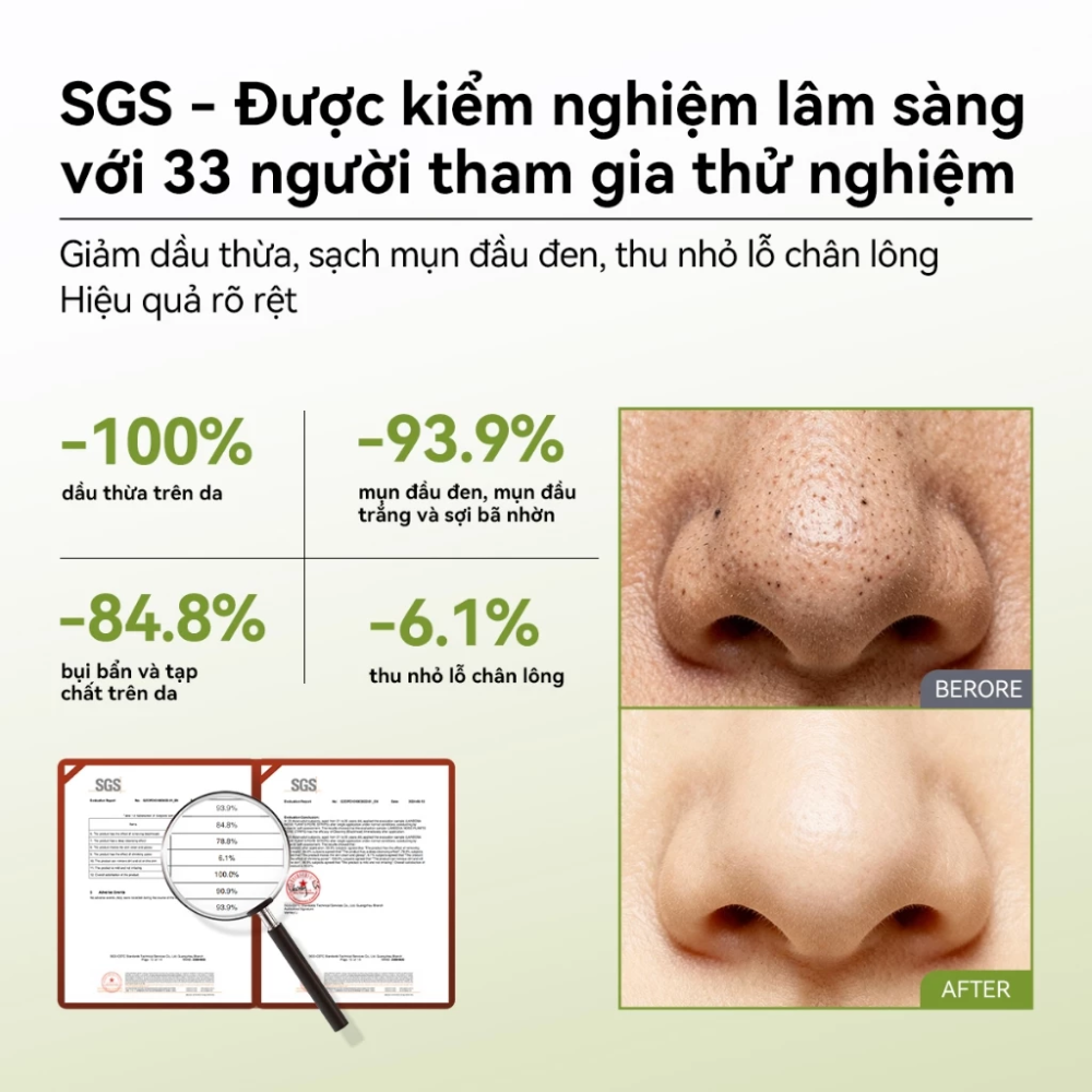 Mặt Nạ Lột Mụn Loại Bỏ Mụn Đầu Đen Lanben Nose Plants Pore Strips 30g