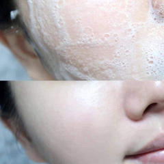 Sữa Rửa Mặt Cho Da Dầu &  Da Mụn Dermacos Anti-Acne Deep Cleansing Gel 150ml