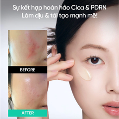 Tinh Chất Làm Dịu Phục Hồi Căng Bóng Da beplain Cica PDRN Skin Booster Serum 30ml