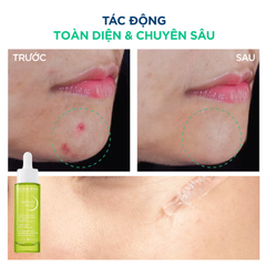 Tinh Chất Dưỡng Sáng Mờ Thâm Cho Da Dầu Mụn Bioderma Sébium Serum 30ml