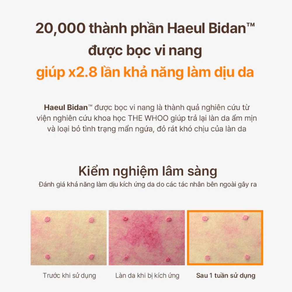 Set Tinh Chất Ngăn Ngừa Lão Hóa Whoo Bichup Treatment Essence Special Set