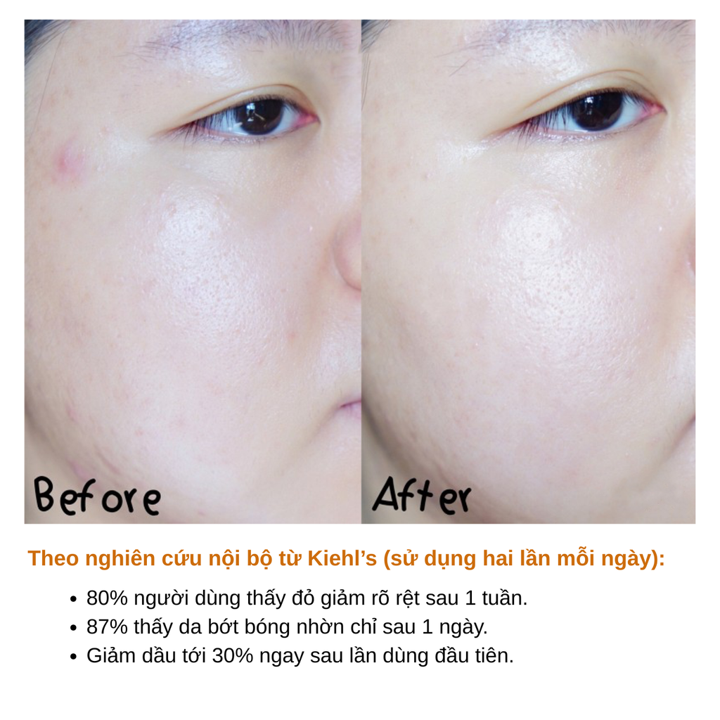 Nước Cân Bằng Làm Dịu Da Kiehl's Calendula Herbal Extract Alcohol-Free Toner