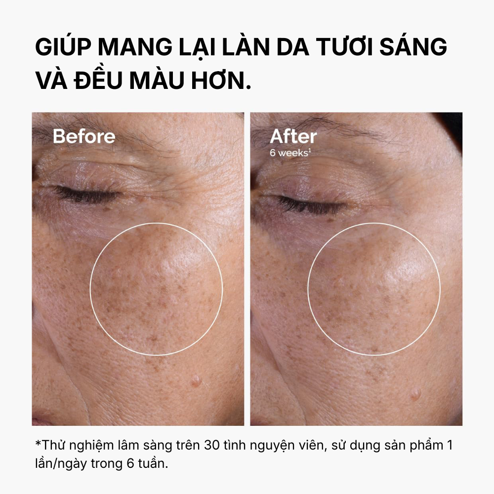 Nước Hoa Hồng Tẩy Da Chết The Ordinary Glycolic Acid 7% Exfoliating Toner 100ml