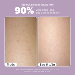 Kem Dưỡng Thể Hỗ Trợ Giảm Mụn Làm Mịn Da Paula's Choice 2% BHA Body Smoothing Spot Exfoliant 210ml