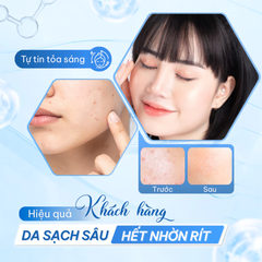 Sữa Rửa Mặt Làm Sạch Giảm Dầu Mụn Compliment Succinic Acid 200ml
