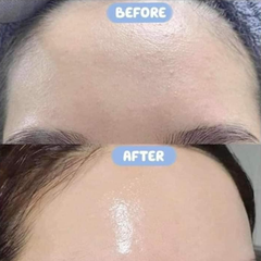 Tinh Chất Phục Hồi Da SMAS Premium Cica Recovery Serum 120ml