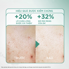 Nước Tẩy Trang Làm Sạch Tế Bào Da Chết Garnier Micellar Exfoliating Water 1% PHA+AHA 400ml