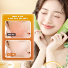 Gel Tẩy Tế Bào Chết Dr.Pepti Centella Turnover Soft Peeling 100ml