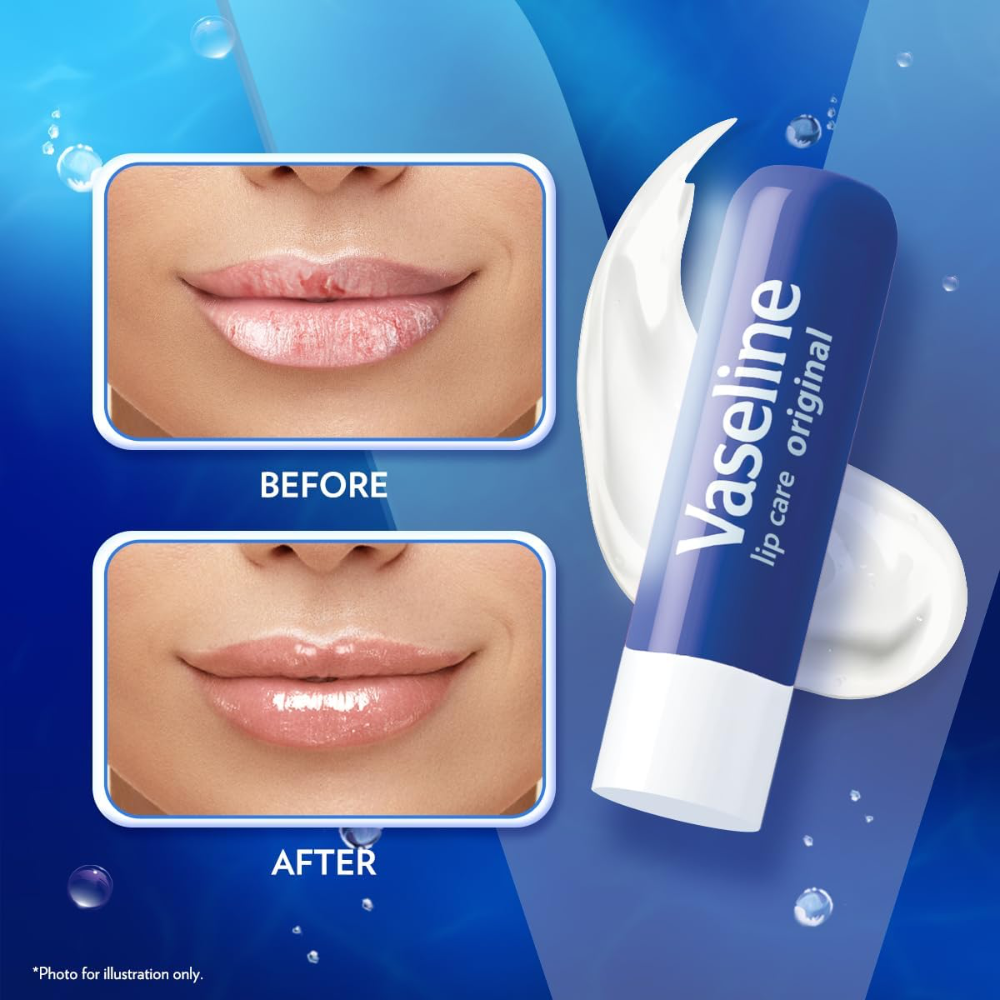 Son Dưỡng Vaseline Lip Therapy 9.6g