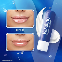 Son Dưỡng Vaseline Lip Therapy 9.6g