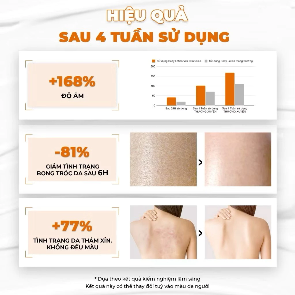 Sữa Dưỡng Thể Dưỡng Trắng & Chống Lão Hóa Mincer Pharma Vita C Infusion Body Lotion 250ml