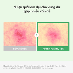 Mặt Nạ Làm Dịu & Phục Hồi Da Mụn Nhạy Cảm Torriden Balanceful Cica Mask 25ml