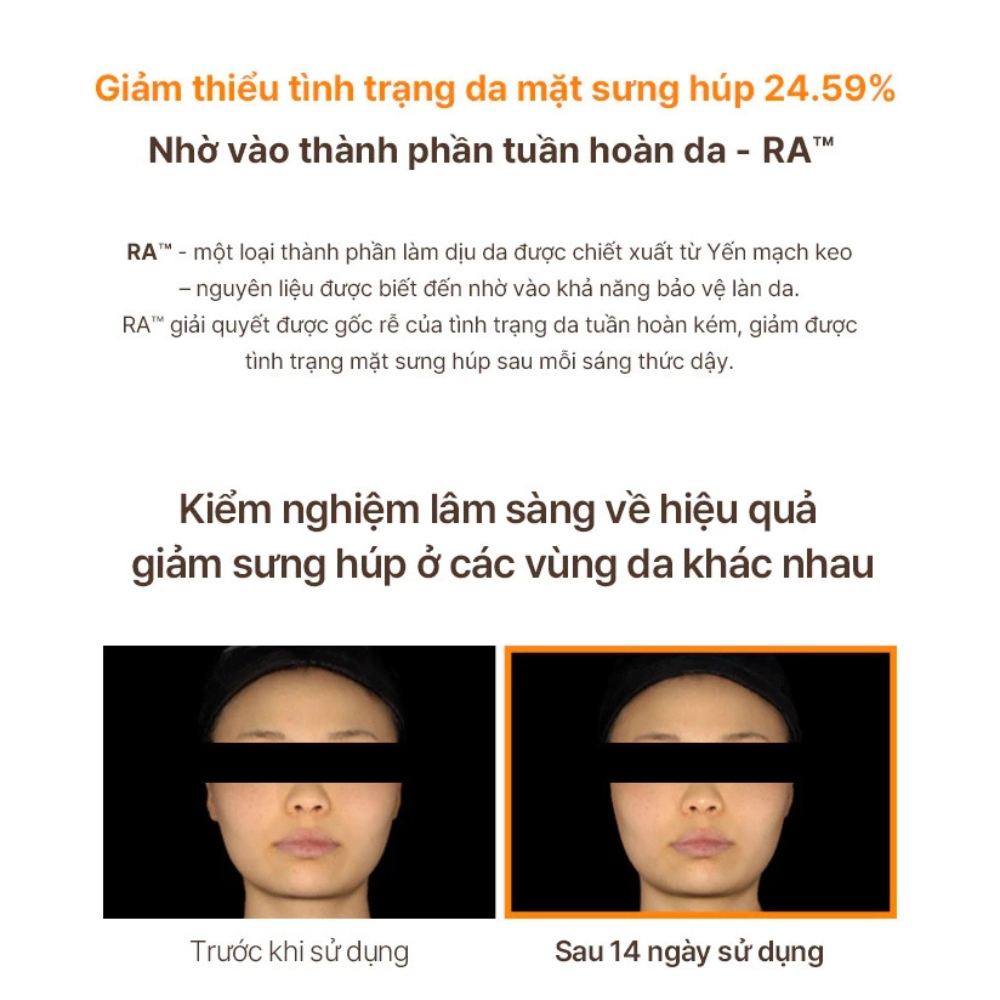 Set Tinh Chất Ngăn Ngừa Lão Hóa Whoo Bichup Treatment Essence Special Set