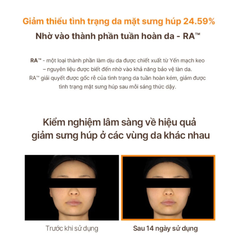 Set Tinh Chất Ngăn Ngừa Lão Hóa Whoo Bichup Treatment Essence Special Set
