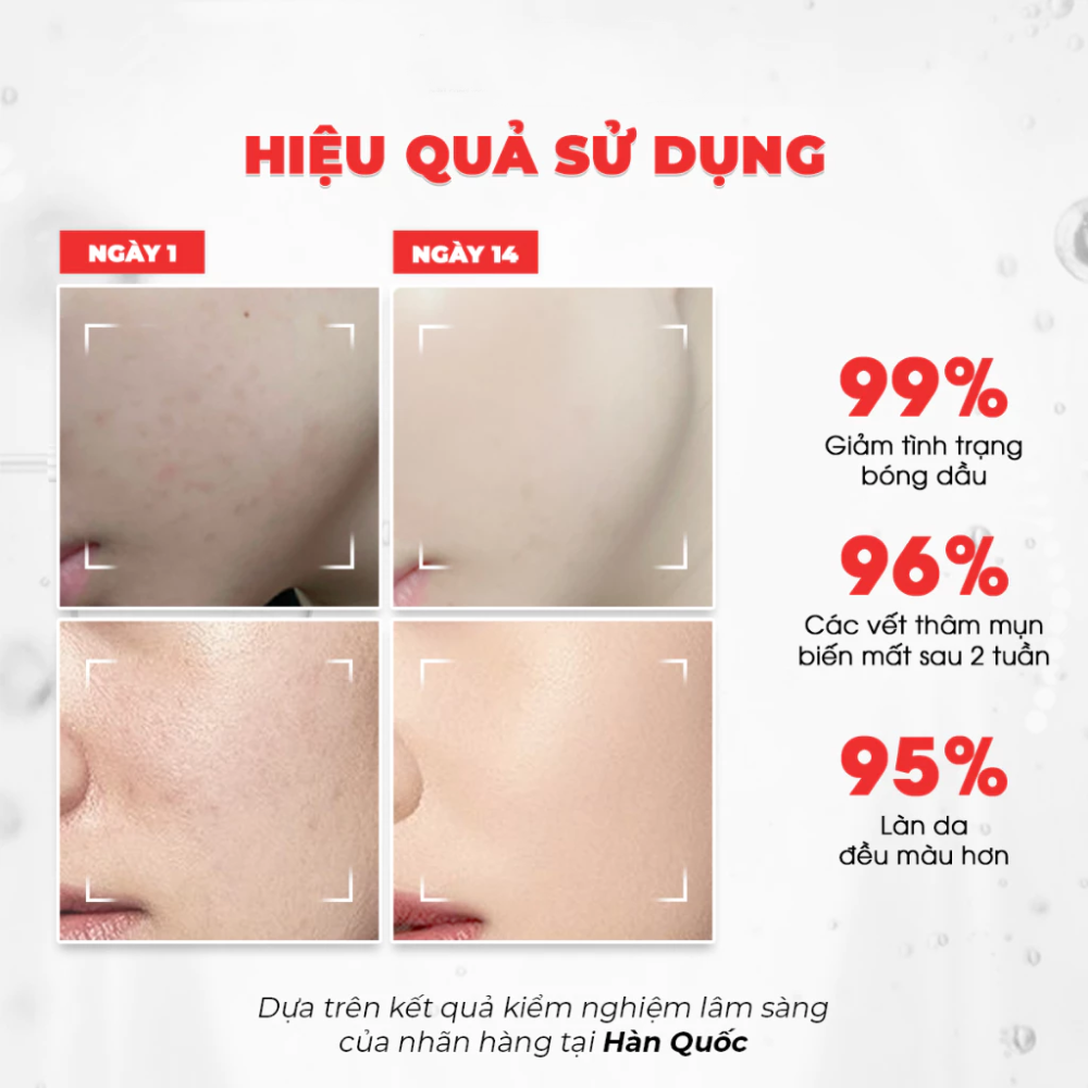 Tinh Chất Dưỡng Trắng Kiểm Soát Dầu Thu Nhỏ Lỗ Chân Lông Angel's Liquid Glutathione Plus Niacinamide Cica Ampoule 45ml
