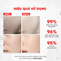 Tinh Chất Dưỡng Trắng Kiểm Soát Dầu Thu Nhỏ Lỗ Chân Lông Angel's Liquid Glutathione Plus Niacinamide Cica Ampoule 45ml
