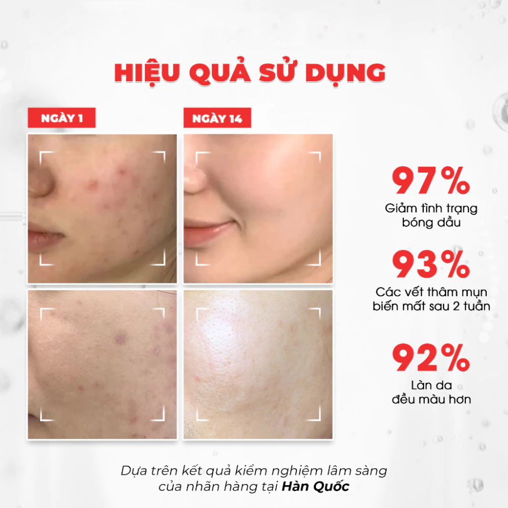 Nước Thần Dưỡng Trắng Kiểm Soát Dầu Thu Nhỏ Lỗ Chân Lông Angel's Liquid Glutathione Plus Niacinamide Cica Essence 150ml