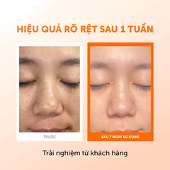 Nước Hoa Hồng Klairs Freshly Juiced Vitamin Essence Toner 30ml