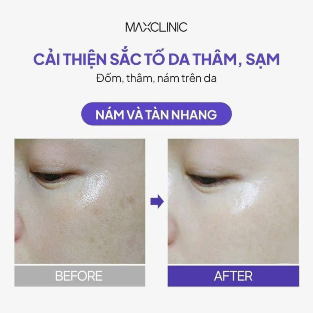 Kem Dưỡng Phục Hồi Sáng Da Maxclinic 7% Melatonin Liposome Cream 50ml