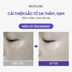Kem Dưỡng Phục Hồi Sáng Da Maxclinic 7% Melatonin Liposome Cream 50ml