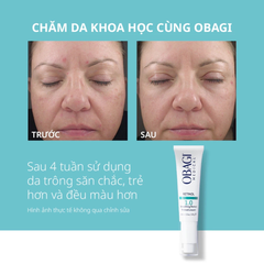 Kem Dưỡng Giảm Nếp Nhăn Obagi Medical Retinol 1.0 Smoothing Retinol 28g