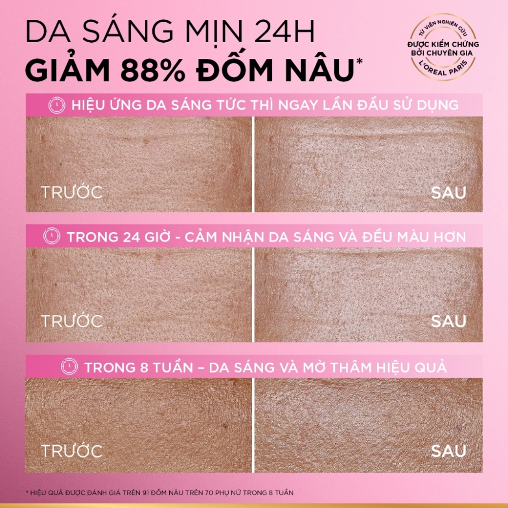 Kem Dưỡng Sáng Da Mờ Thâm Mụn & Nám Loreal Glycolic-Bright Matte Luminizing Cream 30ml