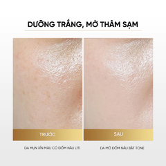 Kem Dưỡng Cấp Ẩm Dưỡng Sáng Da Ban Đêm Eirlys' Alpha Melight 50ml