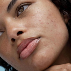 Kem Dưỡng Phục Hồi Da Obagi Rebalance Skin Barrier Recovery Cream 48g