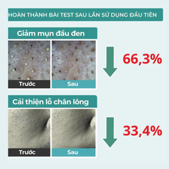 Dung Dịch Giảm Mụn Đầu Đen Jumiso Blackhead Melting Softener Special Kit 150ml