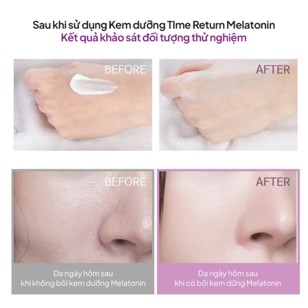 Kem Dưỡng Chống Lão Hóa Maxclinic Time Return Melatonin Liposome 5% Cream 50g