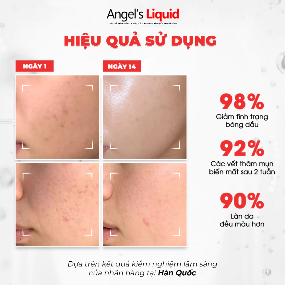 Kem Dưỡng Trắng Kiểm Soát Dầu Thu Nhỏ Lỗ Chân Lông Angel’s Liquid Glutathione Plus Niacinamide Cica Cream 50ml