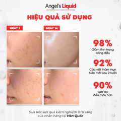 Kem Dưỡng Trắng Kiểm Soát Dầu Thu Nhỏ Lỗ Chân Lông Angel’s Liquid Glutathione Plus Niacinamide Cica Cream 50ml