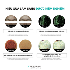 Tinh Chất Hỗ Trợ Phục Hồi Da Rejuran C-PDRN Healer Turnover Ampoule 30ml