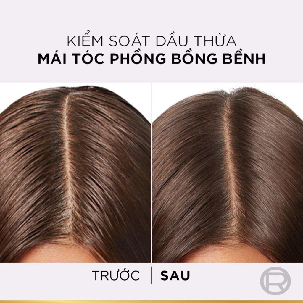 Dầu Gội Giúp Tóc Bồng Bềnh Cho Da Dầu Loreal Hyaluron Pure 72H Purifying Shampoo 620ml