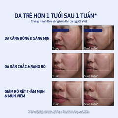 Tinh Chất Chống Lão Hóa Obagi Medical Nu-Gen Cellular Renewal Serum 30ml
