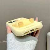  Ốp silicon gà béo nổi 