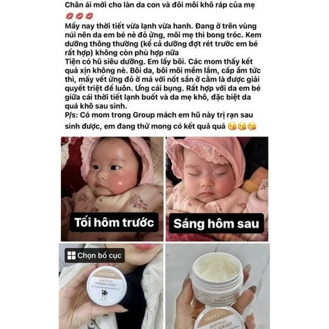  Sáp dưỡng da chống rạn cho mẹ bầu Moogoo 50g 