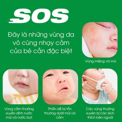  Kem phục hồi chuyên biệt Sos Atono2 20ml 0M+ 