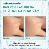  Kem Chống Nắng Vitamin B5 Phục Hồi Da - BENEW Vitamin B5 Daily Sun Protection Face Cream 70ml 