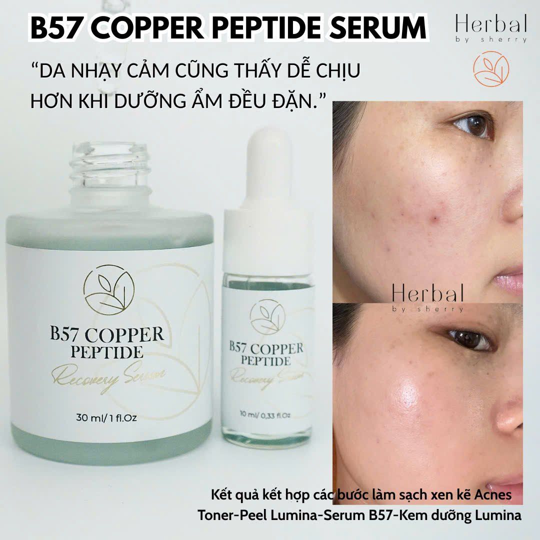  B57 COPPER PEPTIDE  SERUM- Serum đa Peptide cấp ẩm, chống lão hóa, phục hồi, làm dịu và hỗ trợ đầy sẹo 