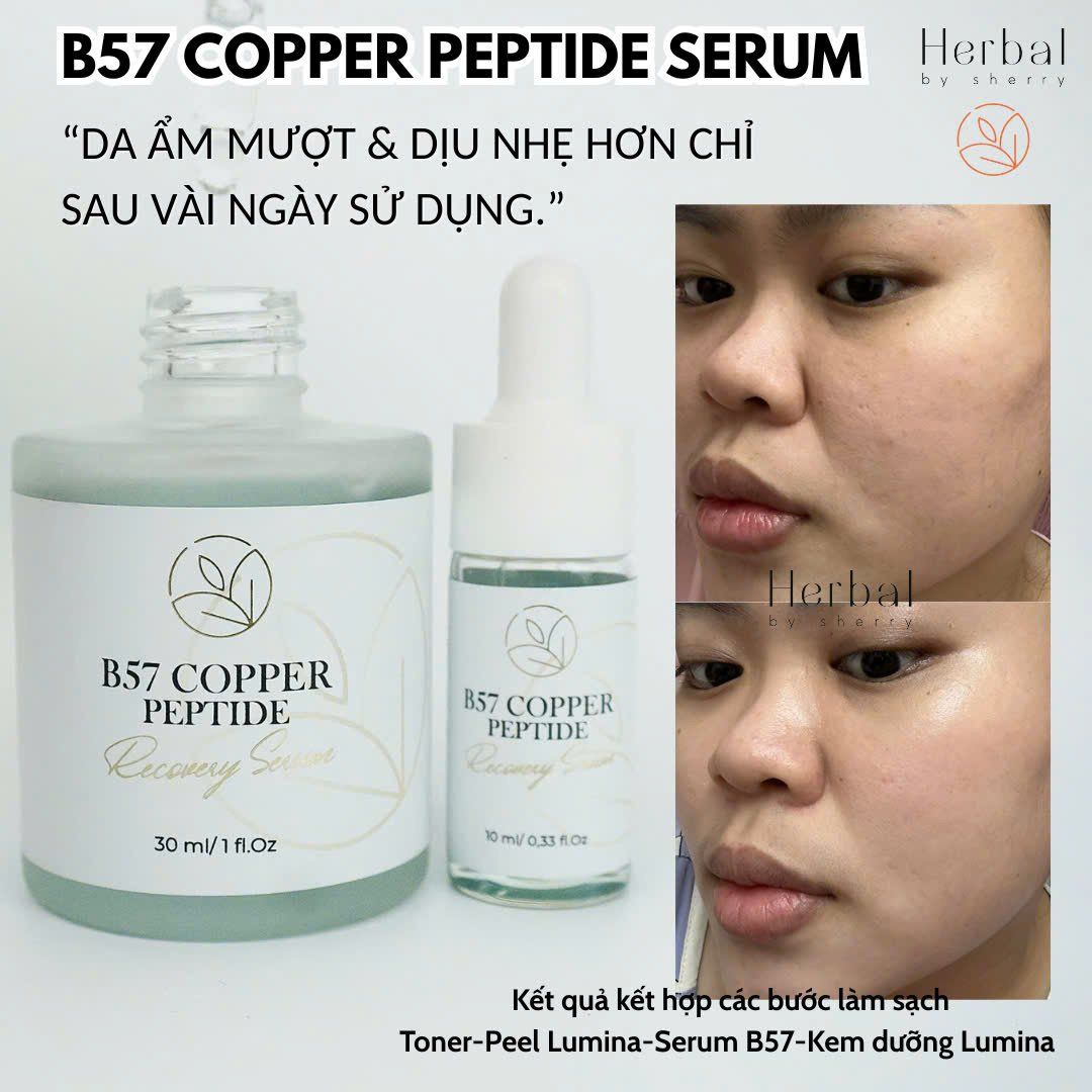  B57 COPPER PEPTIDE  SERUM- Serum đa Peptide cấp ẩm, chống lão hóa, phục hồi, làm dịu và hỗ trợ đầy sẹo 