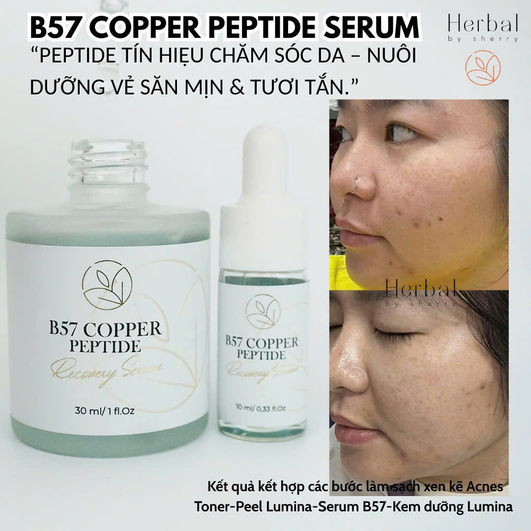  B57 COPPER PEPTIDE  SERUM- Serum đa Peptide cấp ẩm, chống lão hóa, phục hồi, làm dịu và hỗ trợ đầy sẹo 