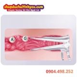  Dụng Cụ Mỏ Vịt Trong Suốt Hỗ Trợ Mở Rộng Âm Đạo Nữ Giới 