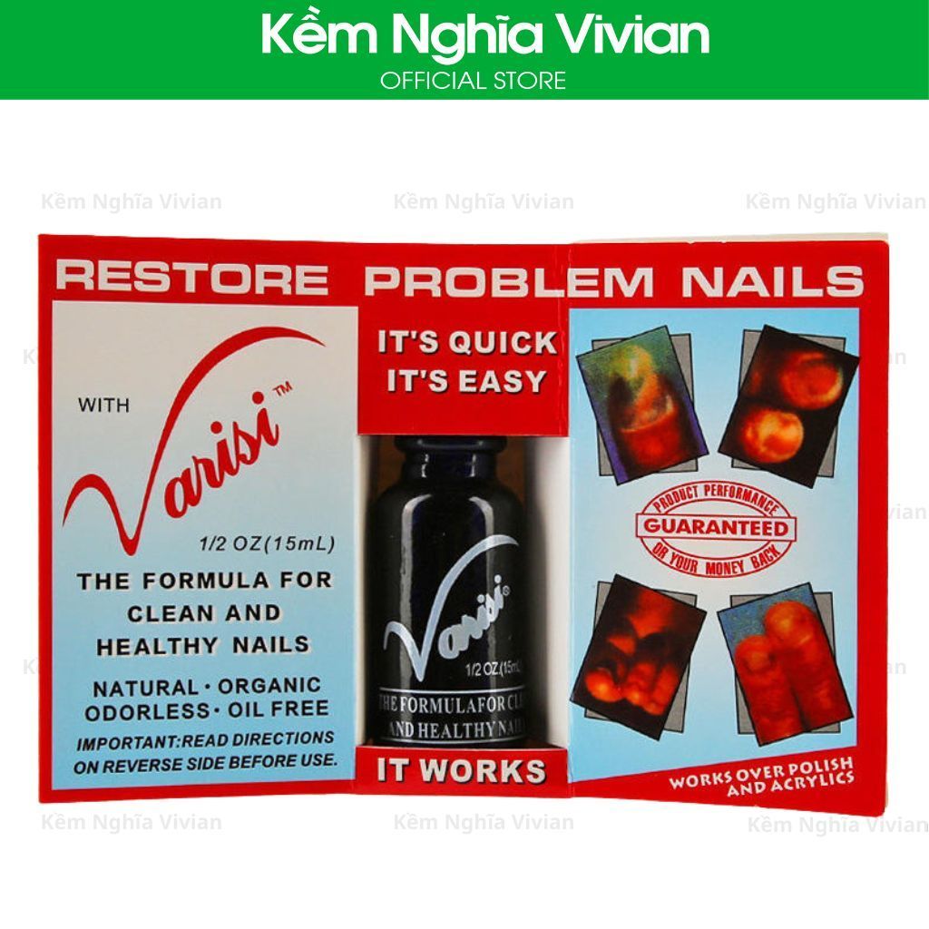  Tinh Chất Chăm Sóc Móng Bị Nấm 65đ 