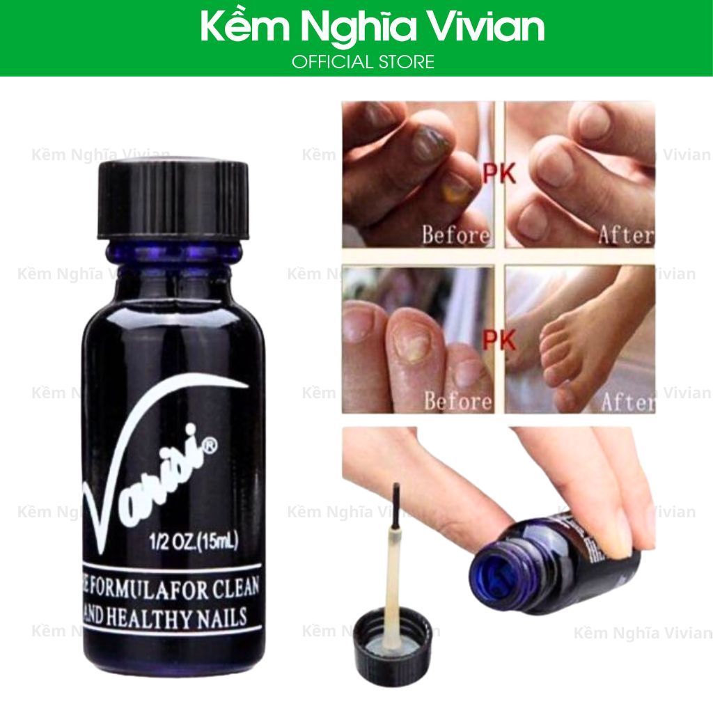  Tinh Chất Chăm Sóc Móng Bị Nấm 65đ 