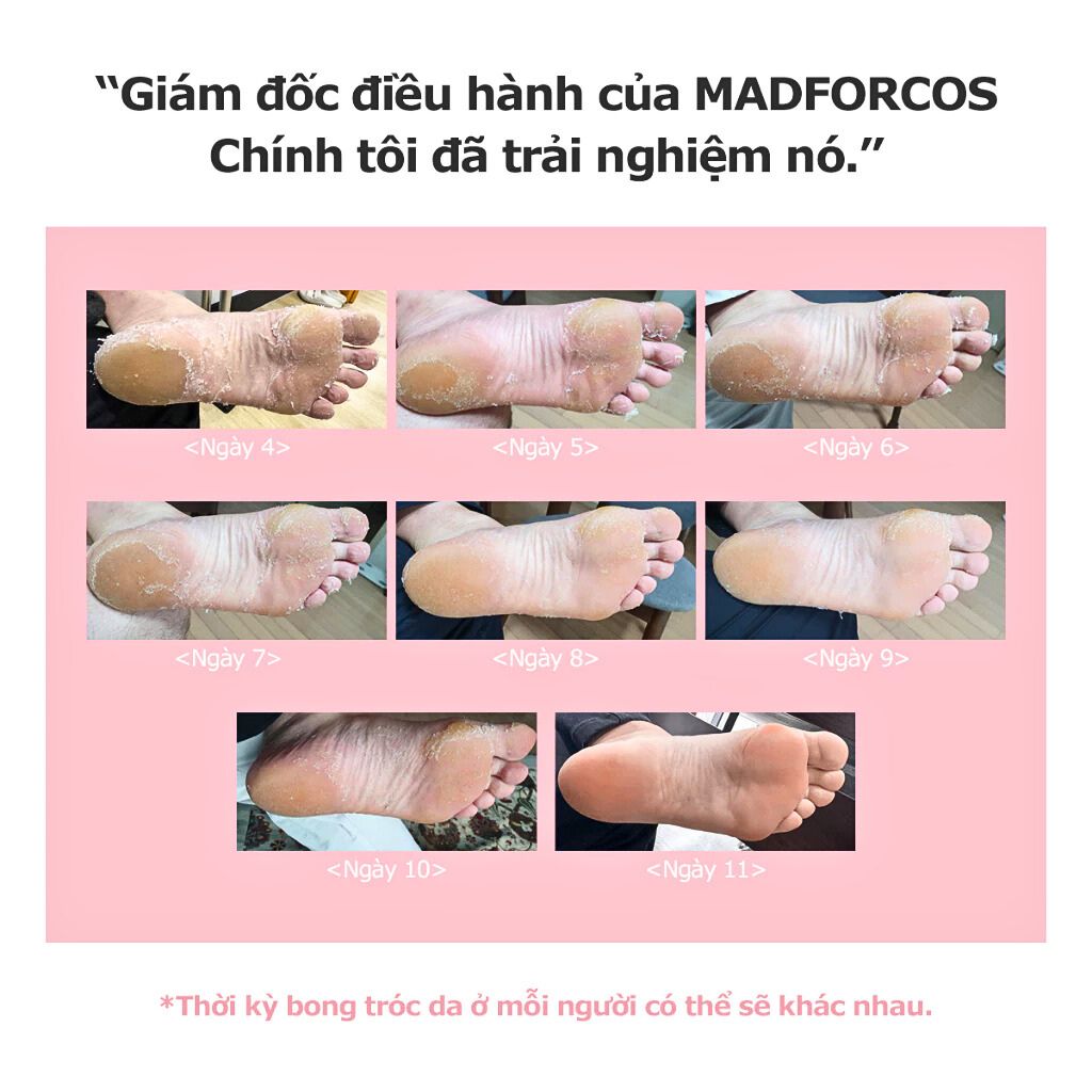  Nạ Dưỡng Ẩm Da Chân Madforcos Silky Coconut Oil - Silky Smooth 