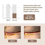  Nạ mắt chống lão hóa Mediheal Retinol Collagen 